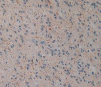 Polyclonal Antibody to Cluster Of Differentiation 161 (CD161)