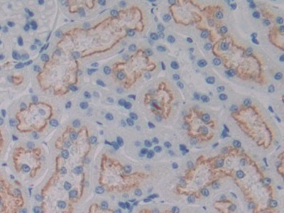 Polyclonal Antibody to Cluster Of Differentiation 320 (CD320)