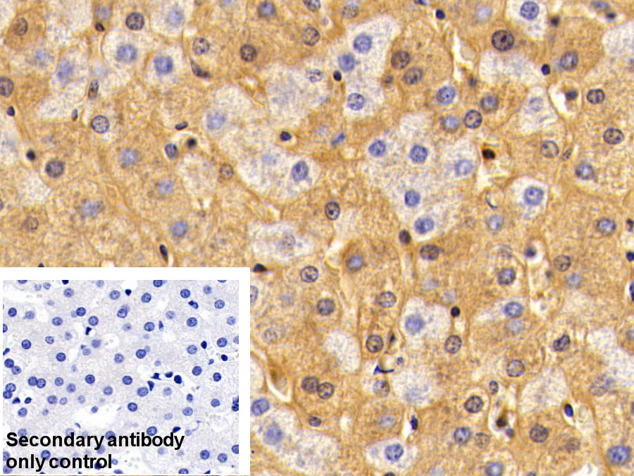 Polyclonal Antibody to Albumin (ALB)