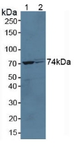 Polyclonal Antibody to Growth Hormone Receptor (GHR)
