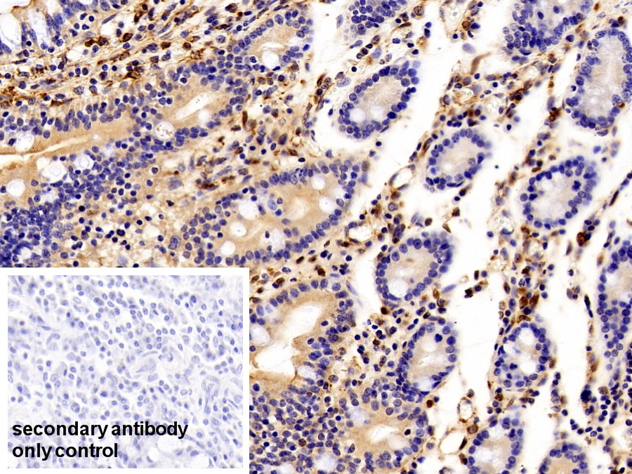 Polyclonal Antibody to Vimentin (VIM)