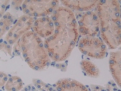 Polyclonal Antibody to Cytochrome P450 7A1 (CYP7A1)