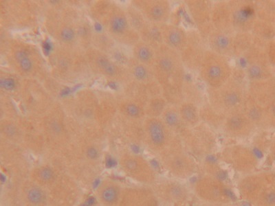 Polyclonal Antibody to Tryptase (TPS)