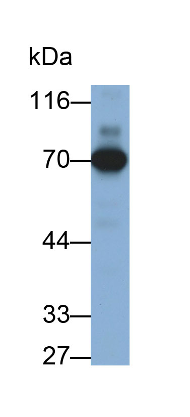 Polyclonal Antibody to Alkaline Phosphatase, Intestinal (ALPI)