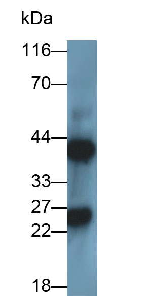Polyclonal Antibody to Glutathione S Transferase Pi (GSTp)