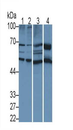 Polyclonal Antibody to Fibrinogen Beta Chain (FGB)