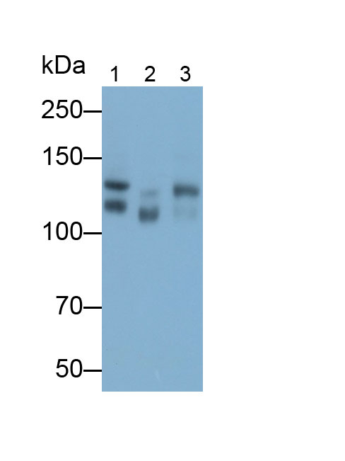 Polyclonal Antibody to Cluster Of Differentiation 56 (CD56)