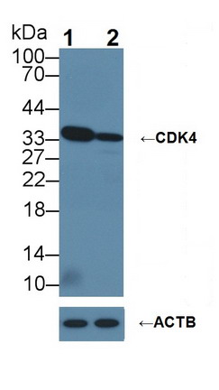 Polyclonal Antibody to Cyclin Dependent Kinase 4 (CDK4)