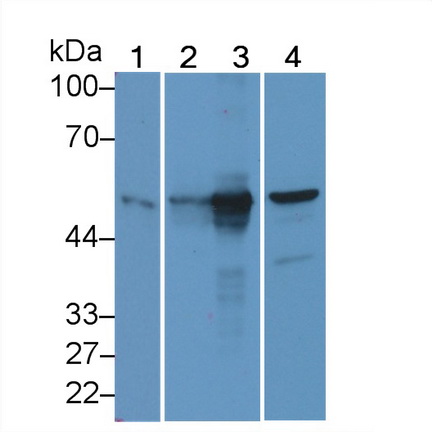 Polyclonal Antibody to Cytokeratin 20 (CK 20)