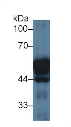 Polyclonal Antibody to Cytokeratin 20 (CK 20)