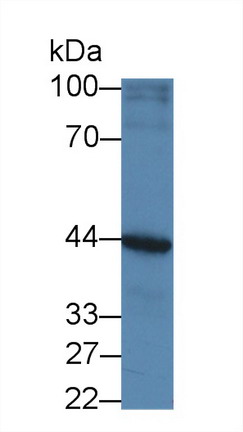 Polyclonal Antibody to Androgen Receptor (AR)