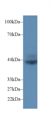 Polyclonal Antibody to Cluster Of Differentiation 72 (CD72)