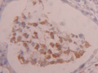 Polyclonal Antibody to Cathepsin D (CTSD)