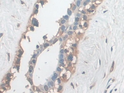 Polyclonal Antibody to Ezrin (EZR)