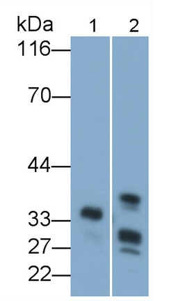 Polyclonal Antibody to Chymotrypsin C (CTRC)