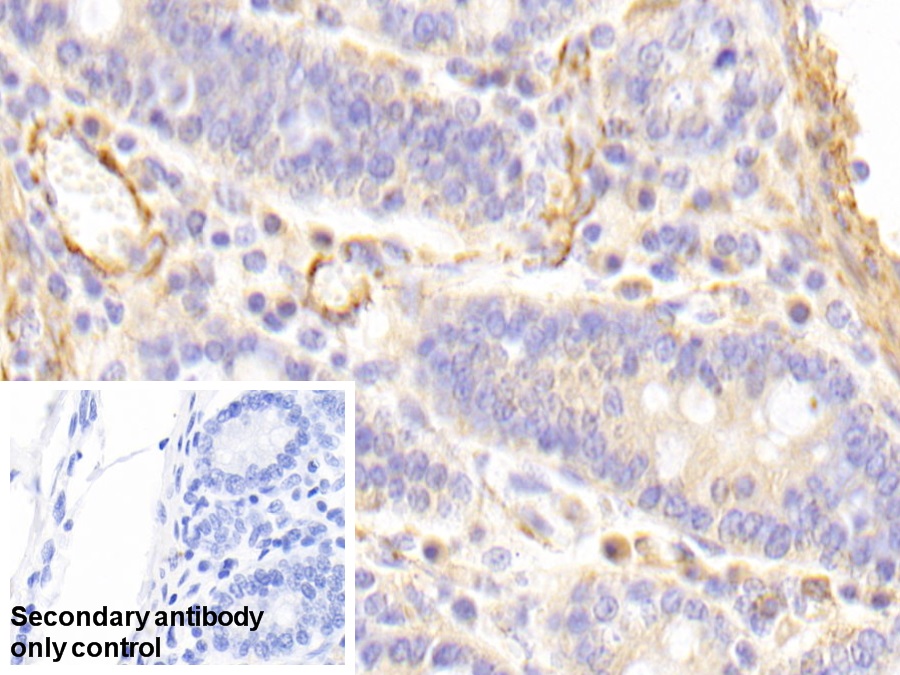 Polyclonal Antibody to Caldesmon (CALD)