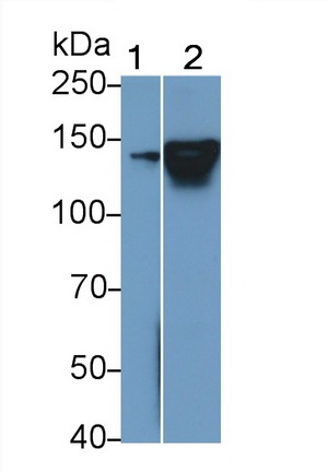 Polyclonal Antibody to Neurofilament 3 (NEF3)