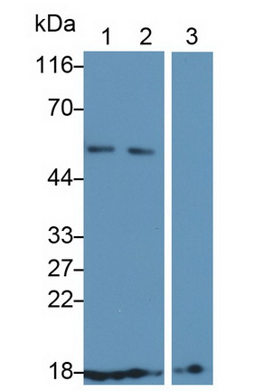 Polyclonal Antibody to Cluster of Differentiation 59 (CD59)