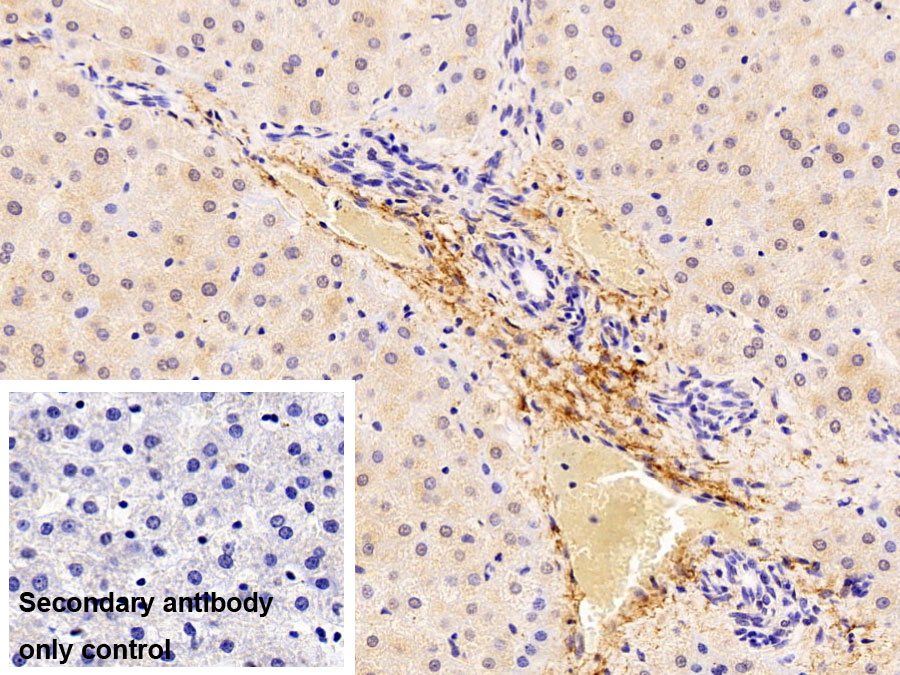 Polyclonal Antibody to Elastin (ELN)