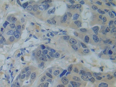 Polyclonal Antibody to Small Nuclear Ribonucleoprotein Polypeptide C (SNRPC)