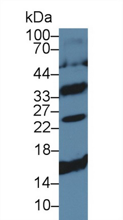 Polyclonal Antibody to Cluster of Differentiation 79B (CD79B)