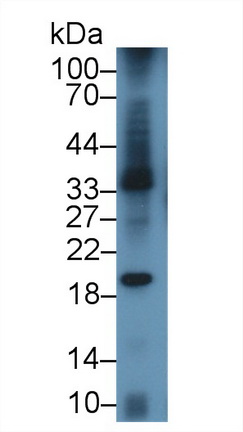 Polyclonal Antibody to B-Lymphocyte Activation Antigen B7-1 (LAB7-1)