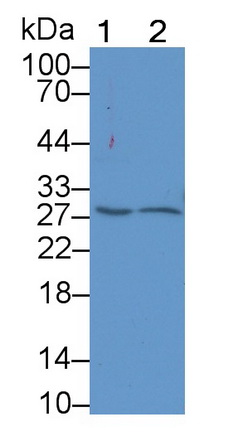 Polyclonal Antibody to Platelet Activating Factor Acetylhydrolase Ib3 (PAFAH1B3)