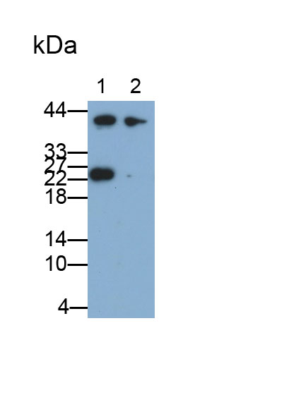 Polyclonal Antibody to Platelet Activating Factor Acetylhydrolase Ib3 (PAFAH1B3)