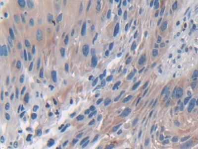 Polyclonal Antibody to Mitogen Activated Protein Kinase 7 (MAPK7)