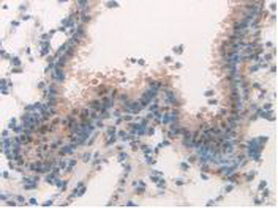 Polyclonal Antibody to Mitogen Activated Protein Kinase 7 (MAPK7)