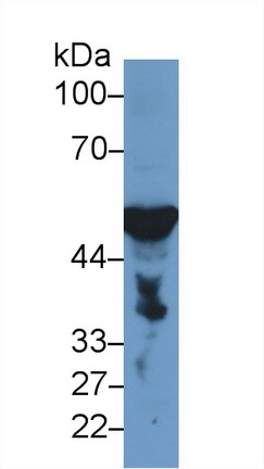 Polyclonal Antibody to Enolase 3 (ENO3)