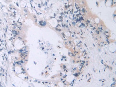 Polyclonal Antibody to Macrophage Erythroblast Attacher (MAEA)