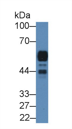 Polyclonal Antibody to Amylase, Alpha 2A (AMY2A)