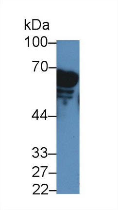 Polyclonal Antibody to Amylase, Alpha 2A (AMY2A)