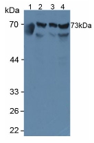 Polyclonal Antibody to Aminopeptidase B (RNPEP)