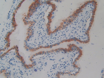 Polyclonal Antibody to Cluster Of Differentiation 109 (CD109)