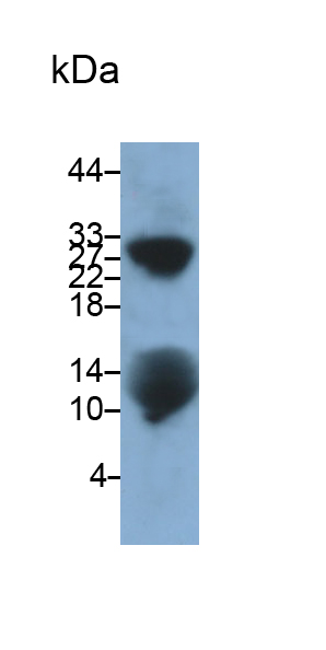 Polyclonal Antibody to Matrix Gla Protein (MGP)