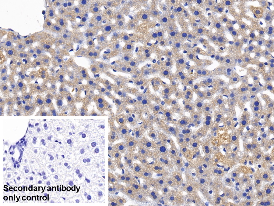 Polyclonal Antibody to Mannose Binding Lectin (MBL)