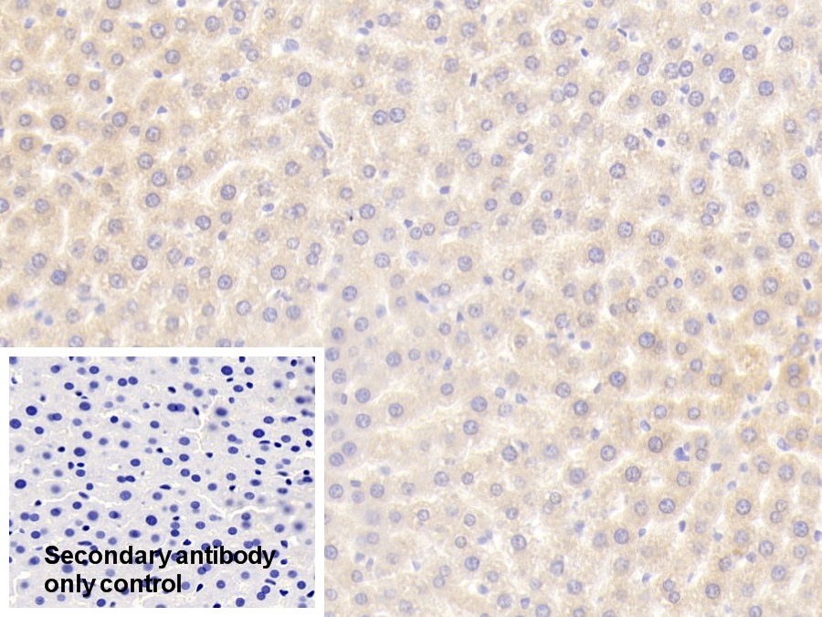 Polyclonal Antibody to Mannose Binding Lectin (MBL)