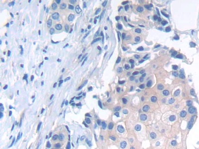 Polyclonal Antibody to N-cadherin (NCAD)