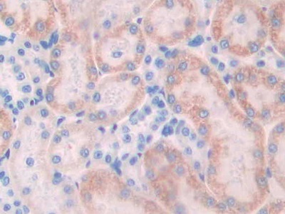 Polyclonal Antibody to N-cadherin (NCAD)