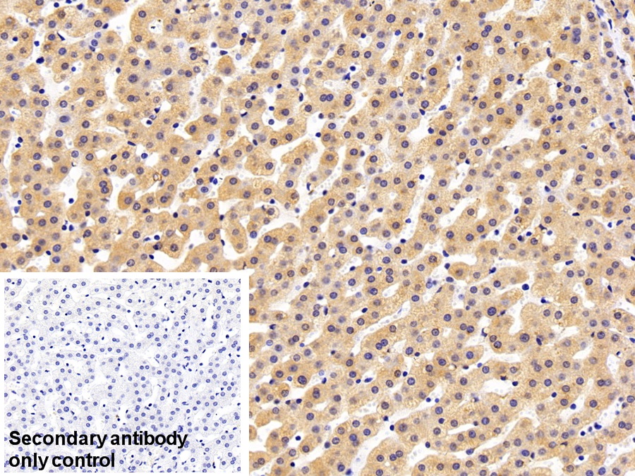 Polyclonal Antibody to Calreticulin (CALR)