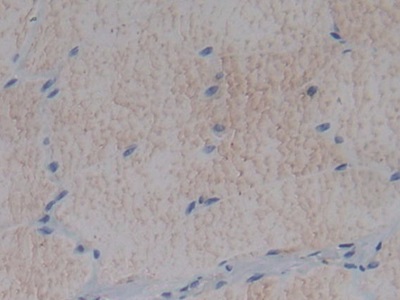Polyclonal Antibody to Fibromodulin (FMOD)