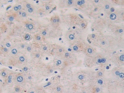 Polyclonal Antibody to Probable ATP-dependent RNA Helicase DDX58 (DDX58)