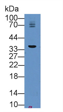 Polyclonal Antibody to Bone Marrow Stromal Cell Antigen 1 (BST1)