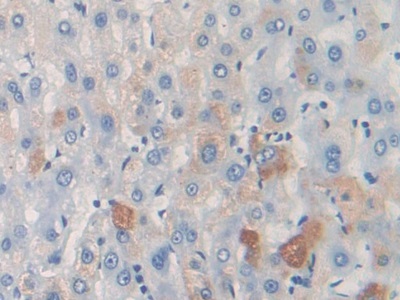 Polyclonal Antibody to Thymus Activation Regulated Chemokine (TARC)