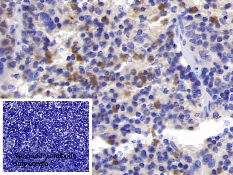 Polyclonal Antibody to Receptor I For The Fc Region Of Immunoglobulin E (FceRI)