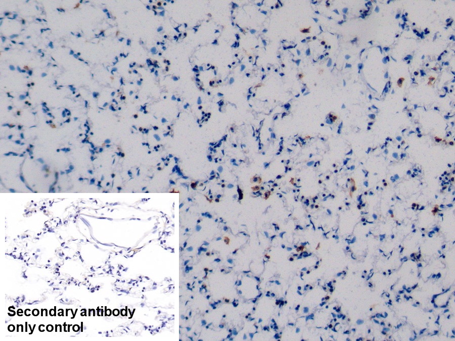 Polyclonal Antibody to Surfactant Protein C (SP-C)