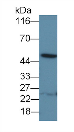 Polyclonal Antibody to Interleukin 13 Receptor Alpha 1 (IL13Ra1)