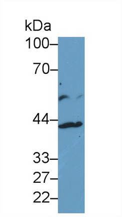 Polyclonal Antibody to Interleukin 13 Receptor Alpha 2 (IL13Ra2)
